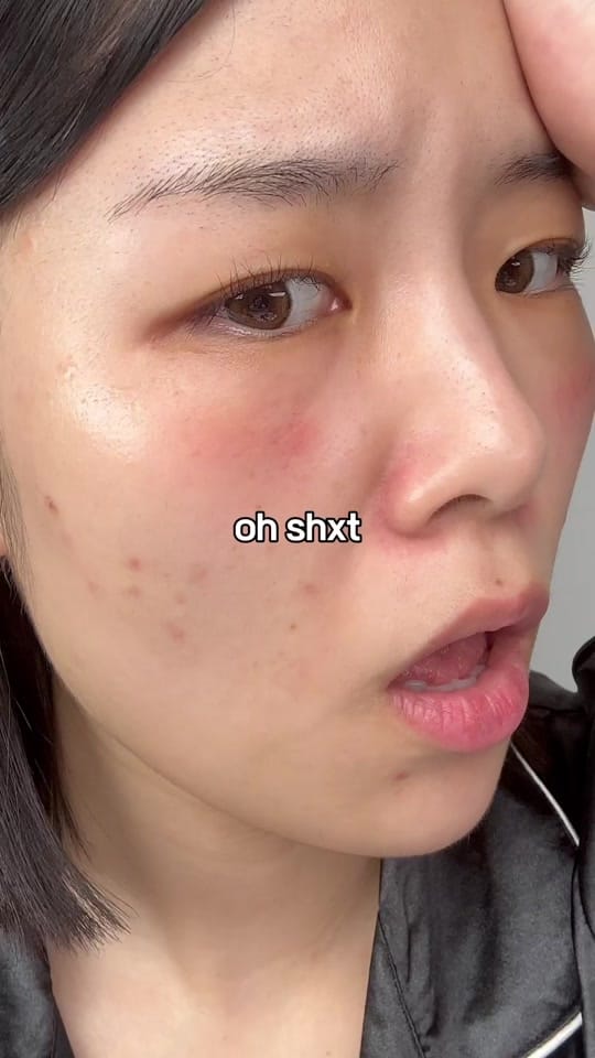 Post 6 by malangcutiee 🫧 I Kbeauty on TikTok (video)