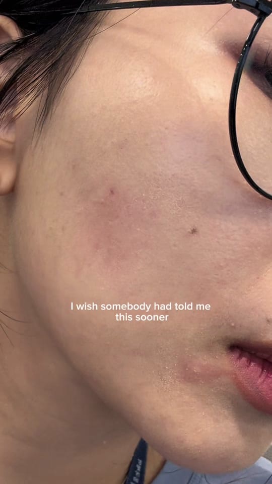 Post 7 by Jes | Skincare Zombie🧟‍♀️ on TikTok (video)