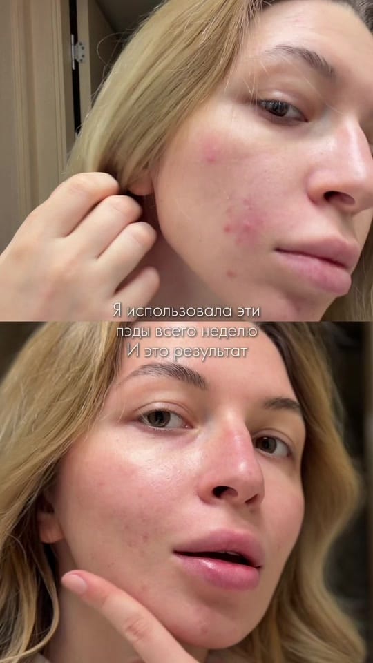 Post 1 by MASHA ROKO on TikTok (video)
