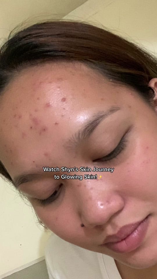Post 10 by Seoul Ceuticals on TikTok (video)