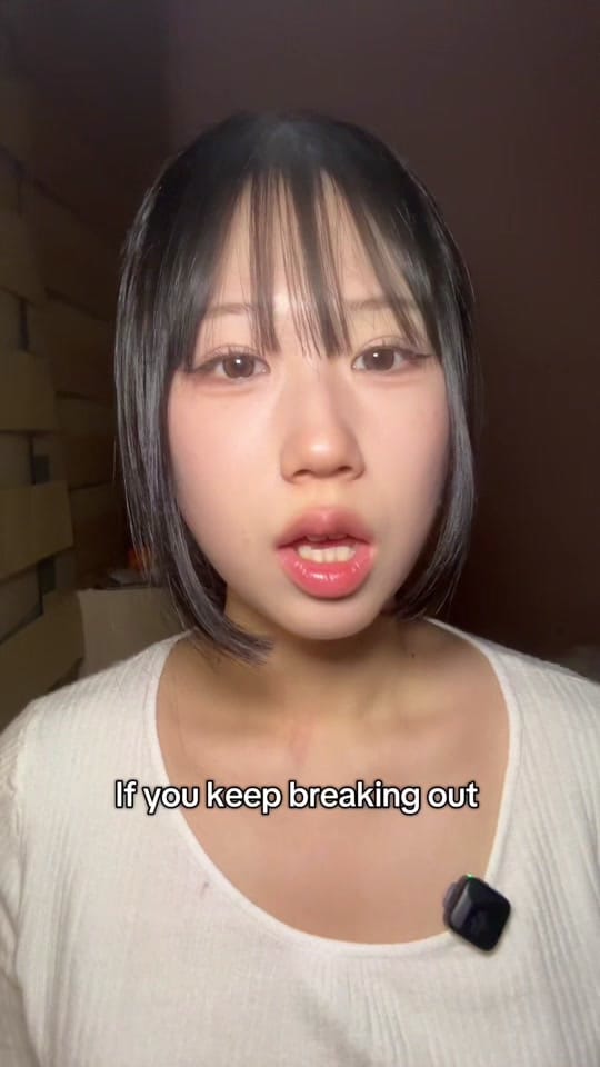 Post 7 by frekkie on TikTok (video)