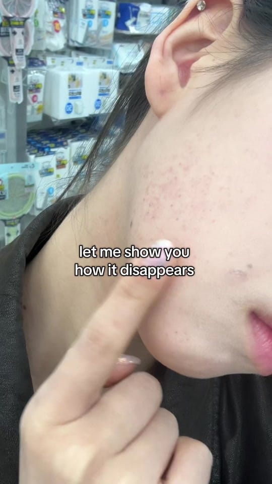 Post 5 by frekkie on TikTok (video)