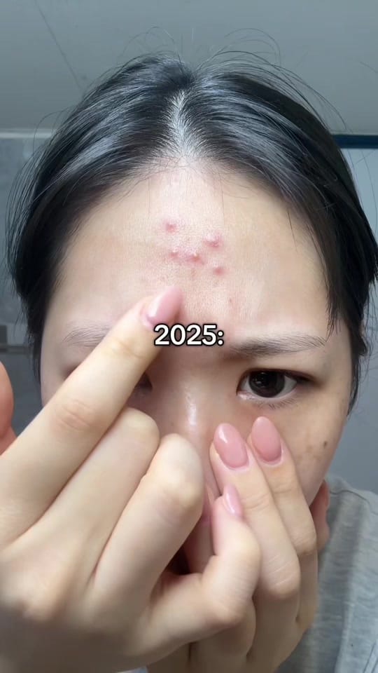 Post 4 by frekkie on TikTok (video)