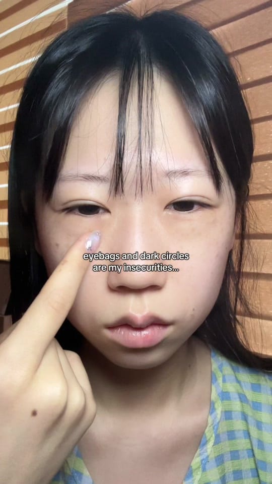 Post 6 by frekkie on TikTok (video)