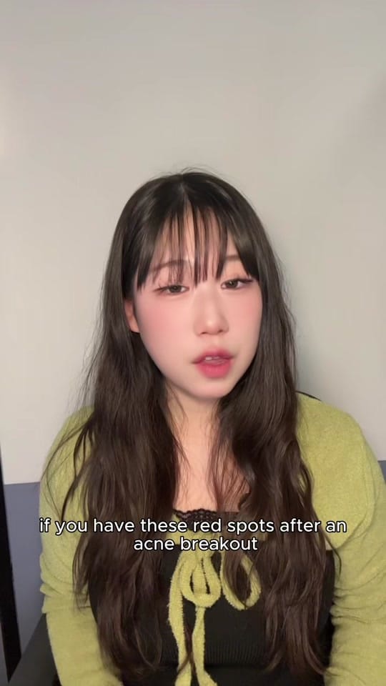 Post 8 by frekkie on TikTok (video)