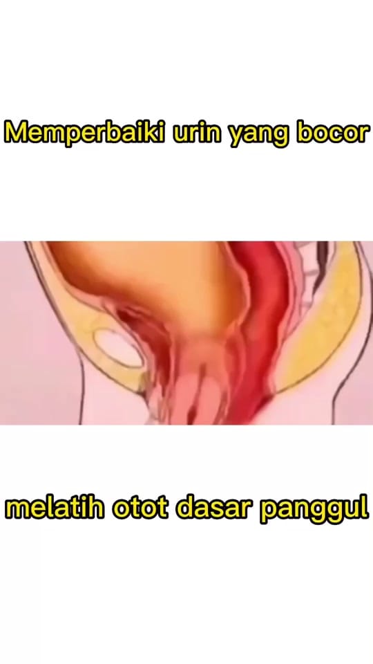 Post 10 by Lauwis_Ricky on TikTok (video)