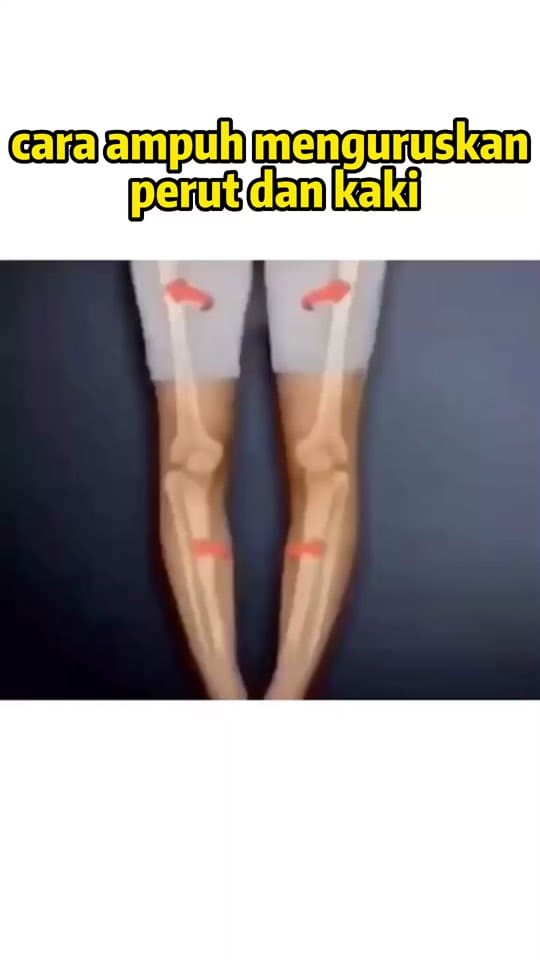 Post 4 by Lauwis_Ricky on TikTok (video)