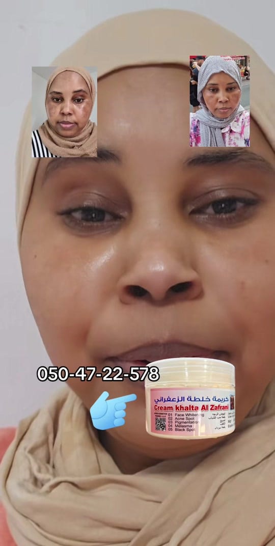 Post 7 by Zafrani cream original 💎 on TikTok (video)