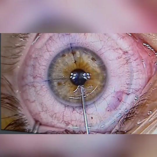 Post 8 by Dr. Özgür Kiriş on TikTok (video)
