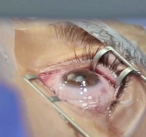 Post 2 by Dr. Özgür Kiriş on TikTok (video)
