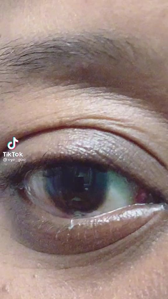 Post 10 by Dr. Özgür Kiriş on TikTok (video)