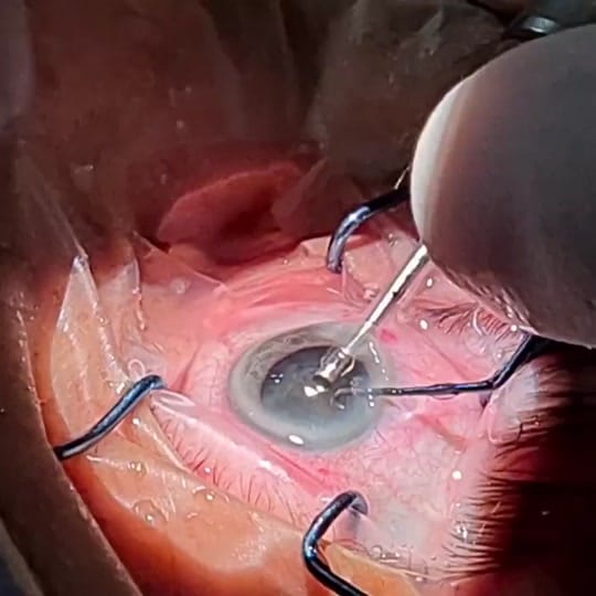 Post 7 by Dr. Özgür Kiriş on TikTok (video)