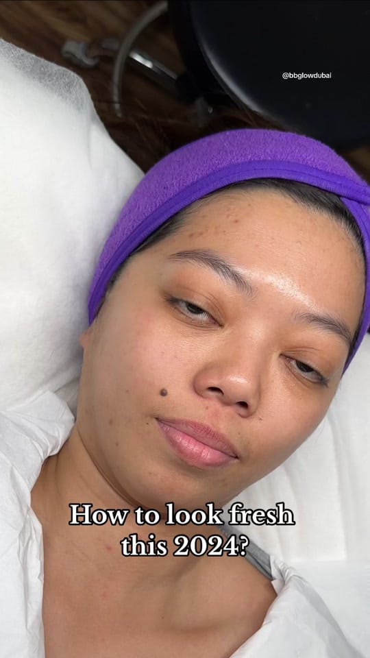 Post 1 by BBGLOW DUBAI 🇦🇪 on TikTok (video)