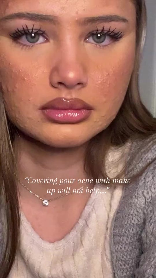 Post 4 by BBGLOW DUBAI 🇦🇪 on TikTok (video)