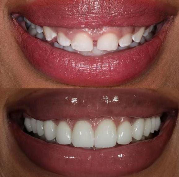 Post 3 by Dr. Victoria Veytsman DDS on TikTok (video)