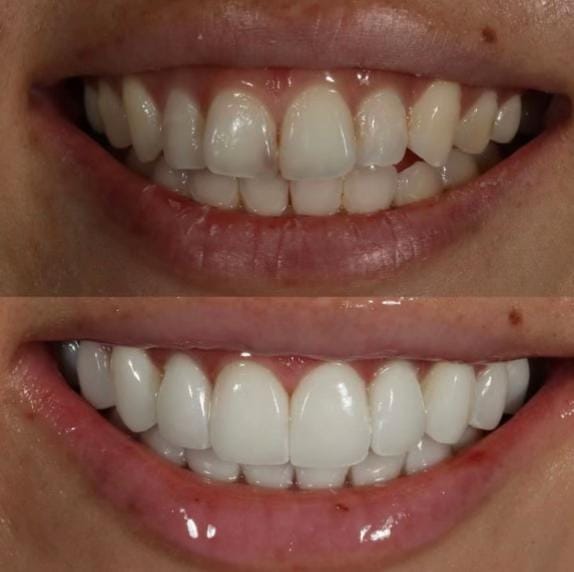 Post 5 by Dr. Victoria Veytsman DDS on TikTok (video)
