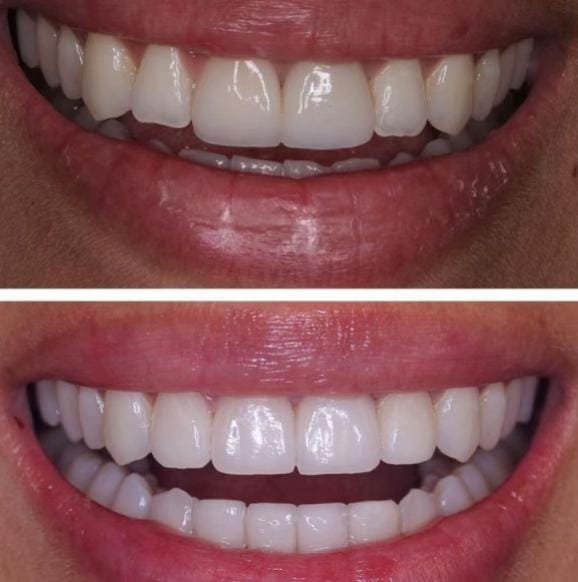 Post 1 by Dr. Victoria Veytsman DDS on TikTok (video)