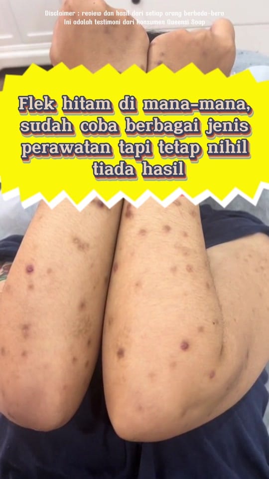 Post 6 by Zala Beauty GUMMI on TikTok (video)