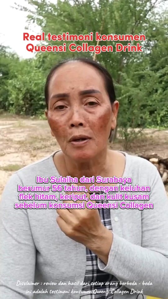 Post 9 by Zala Beauty GUMMI on TikTok (video)