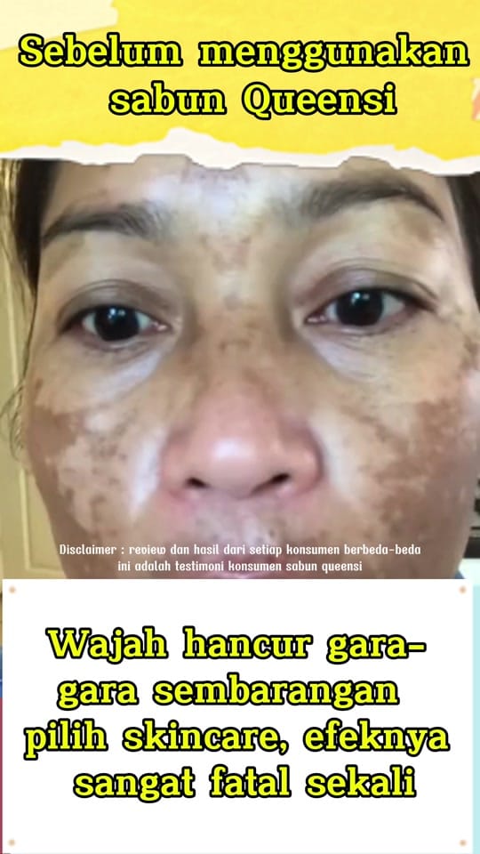 Post 7 by Zala Beauty GUMMI on TikTok (video)
