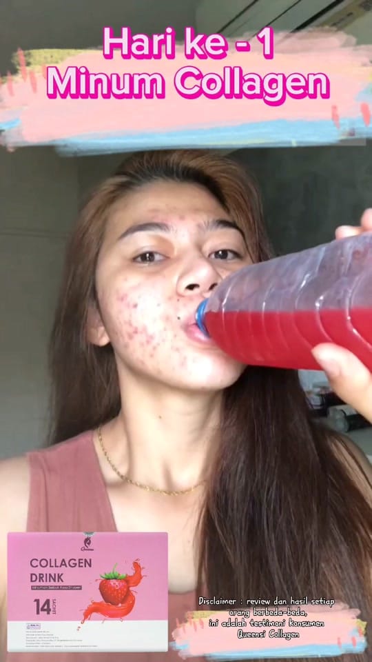 Post 10 by Zala Beauty GUMMI on TikTok (video)