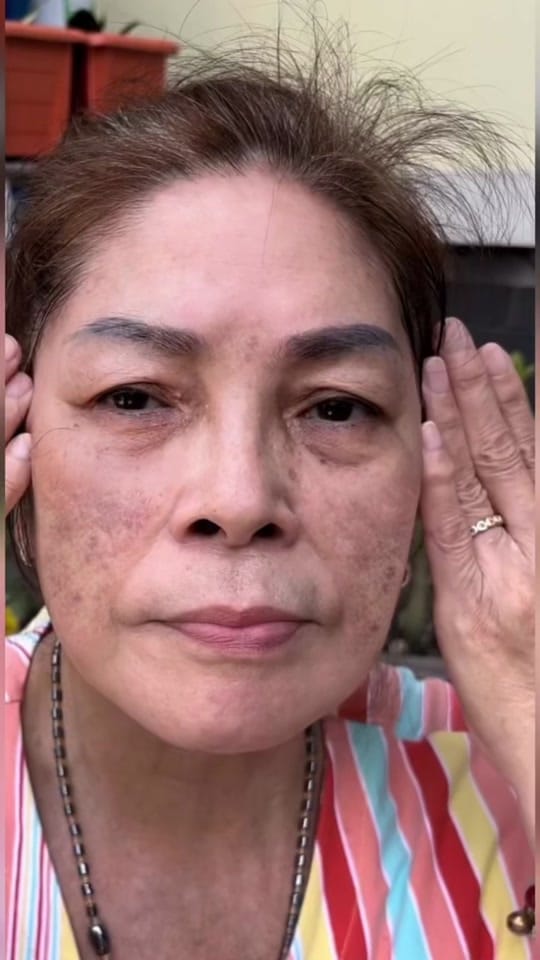 Post 5 by Zala Beauty GUMMI on TikTok (video)