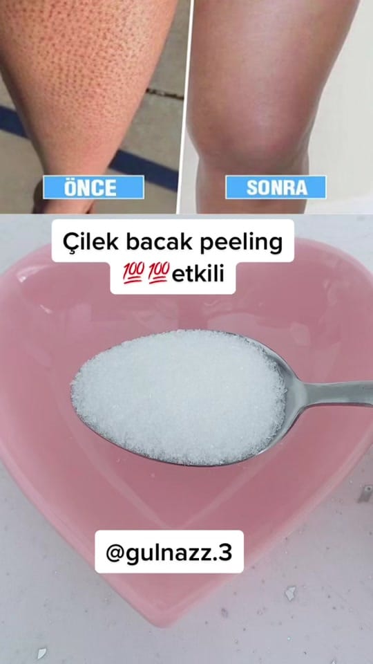 Post 5 by Gülll on TikTok (video)