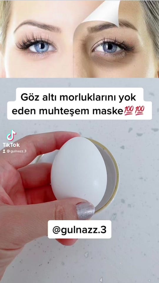 Post 6 by Gülll on TikTok (video)