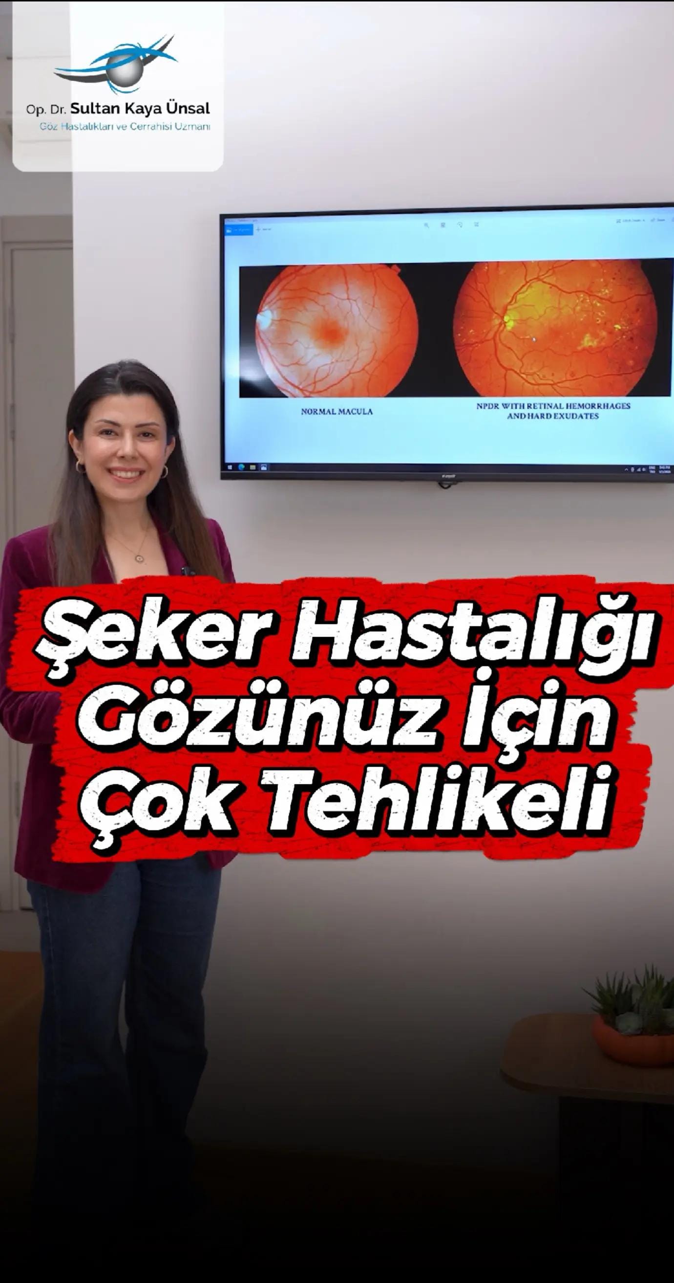 Post 6 by Op. Dr. Sultan Kaya Ünsal on TikTok (video)