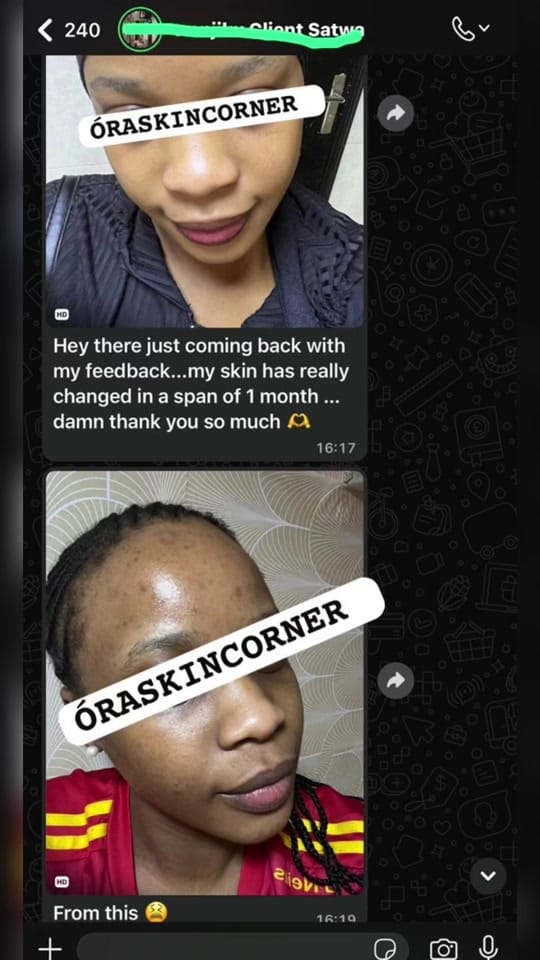Post 3 by ÓRA SKIN CORNER 🇦🇪 on TikTok (video)