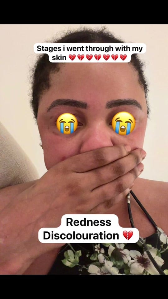Post 4 by ÓRA SKIN CORNER 🇦🇪 on TikTok (video)