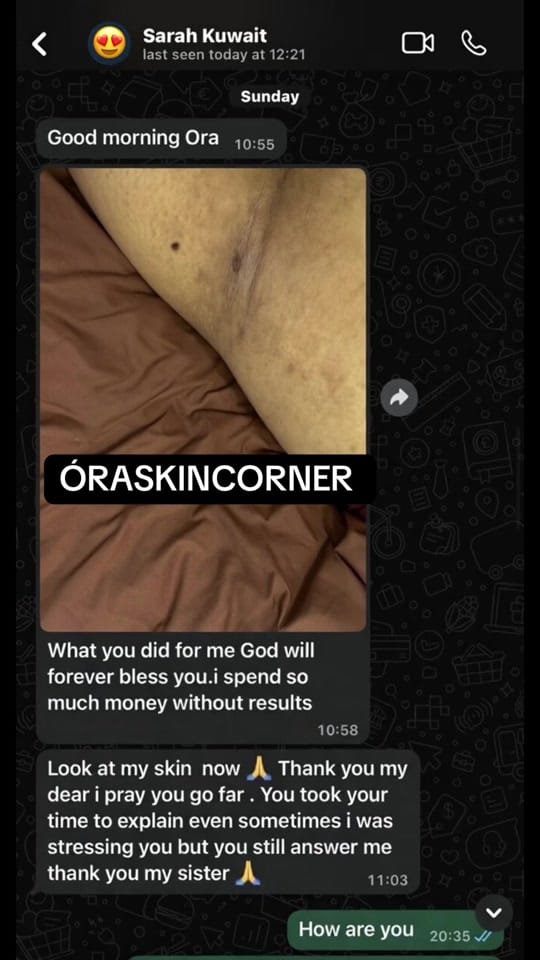 Post 9 by ÓRA SKIN CORNER 🇦🇪 on TikTok (video)
