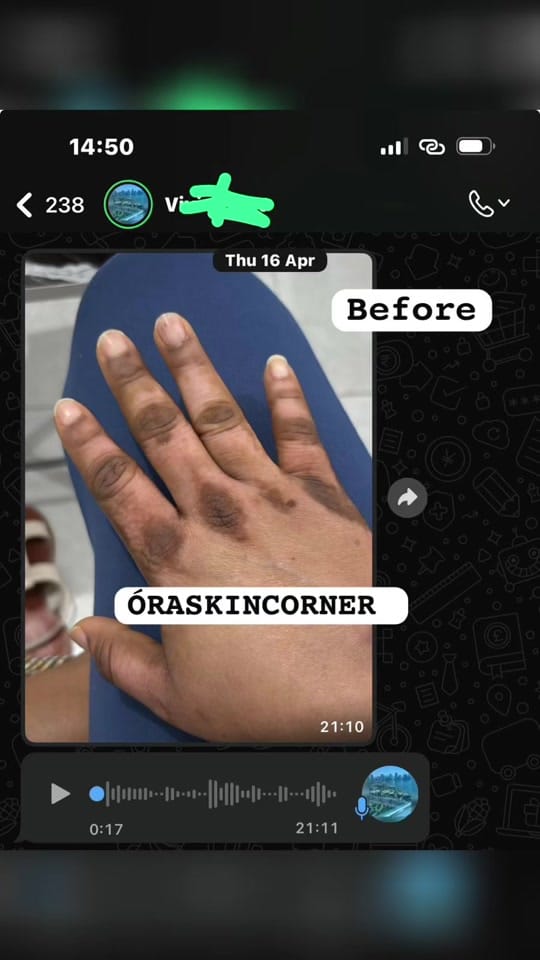 Post 2 by ÓRA SKIN CORNER 🇦🇪 on TikTok (video)