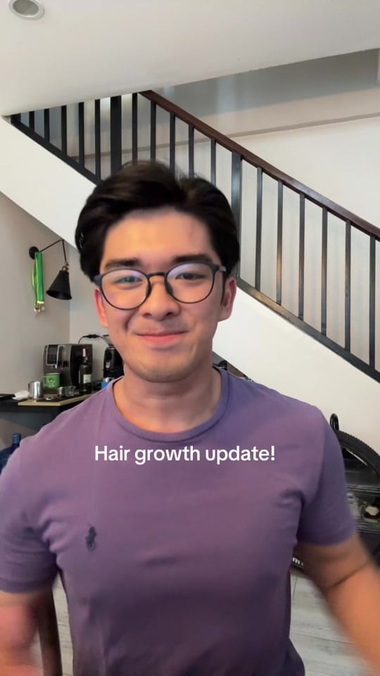 Post 10 by eyebandelara on IG on TikTok (video)