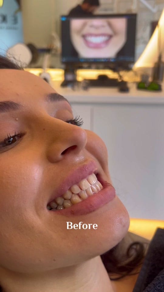 Post 8 by Omer Ekiz on TikTok (video)