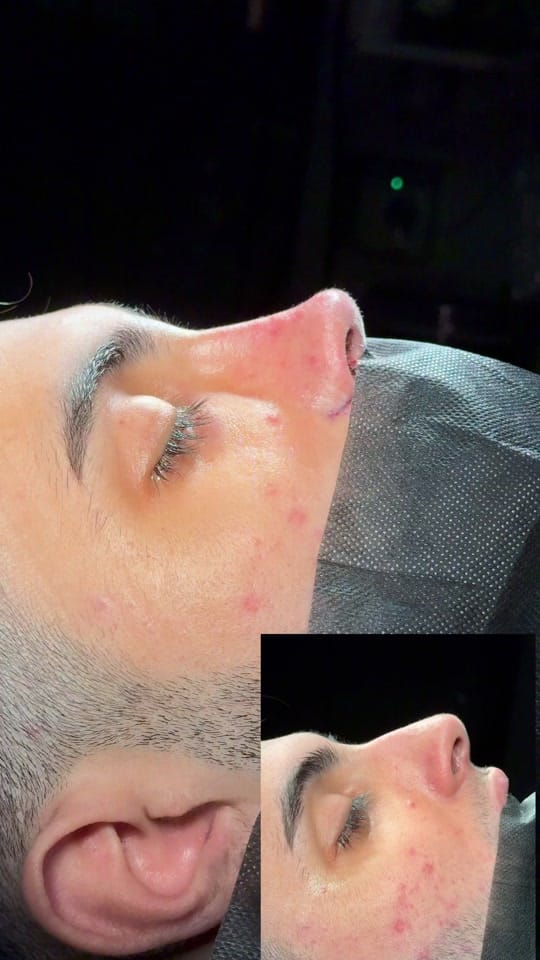 Post 6 by Op. Dr. Cemal Hacı on TikTok (video)