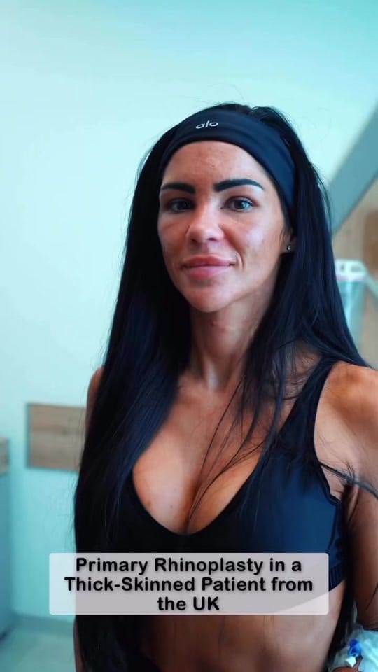Post 2 by Op. Dr. Cemal Hacı on TikTok (video)