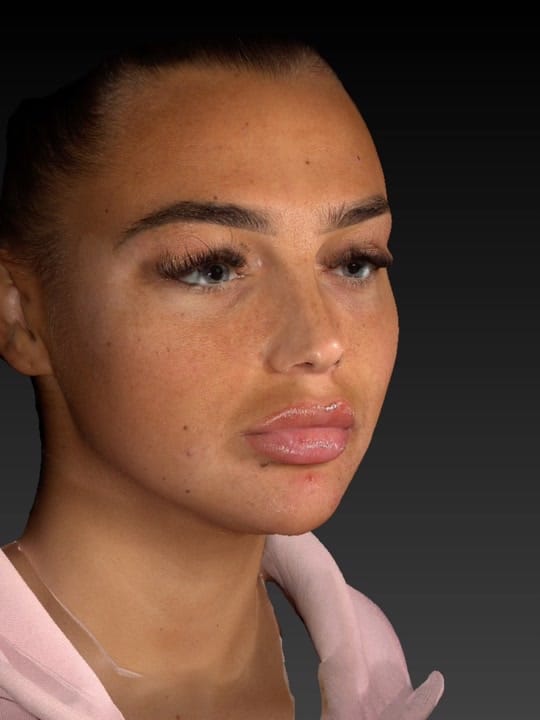 Post 5 by Op. Dr. Cemal Hacı on TikTok (video)