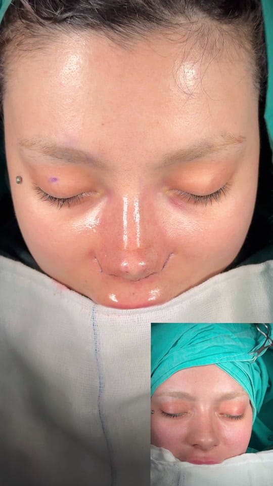 Post 8 by Op. Dr. Cemal Hacı on TikTok (video)