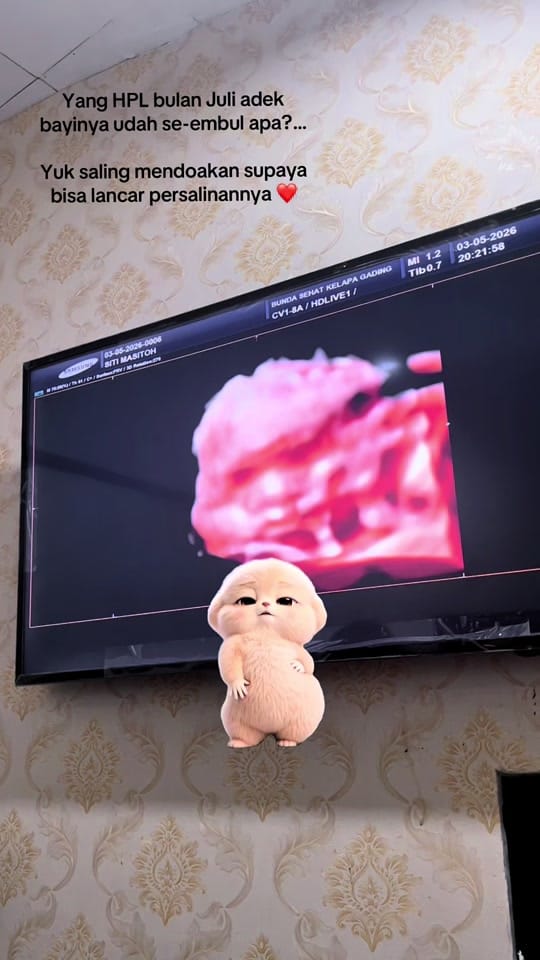 Post 5 by Siti Masitoh on TikTok (video)