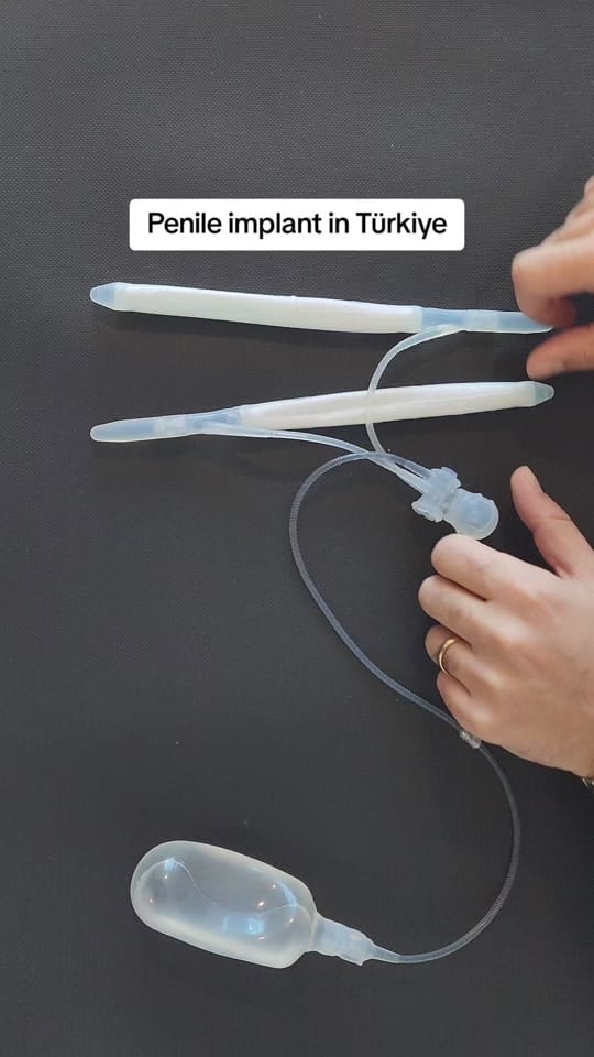 Post 8 by Istanbul Urology Clinic on TikTok (video)