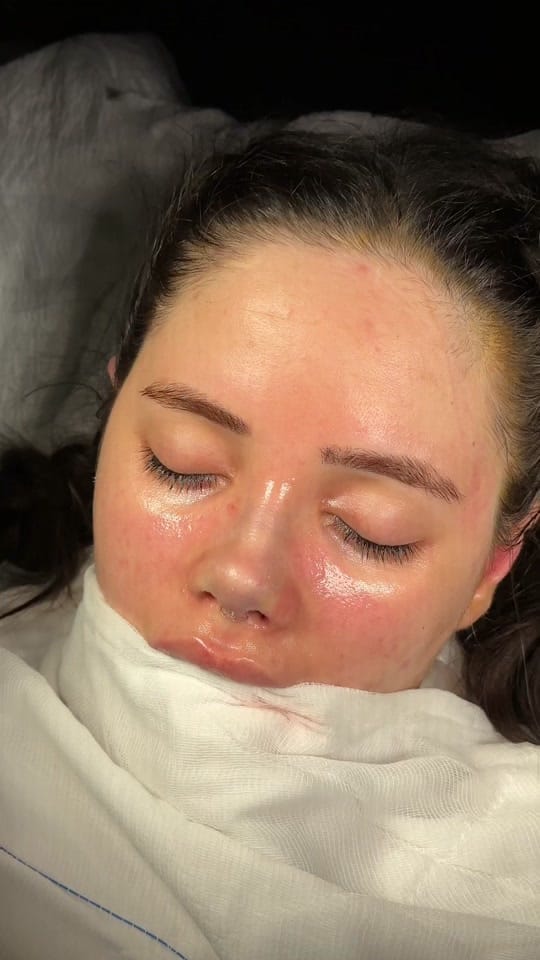 Post 7 by Op. Dr. Fatih Akgün on TikTok (video)