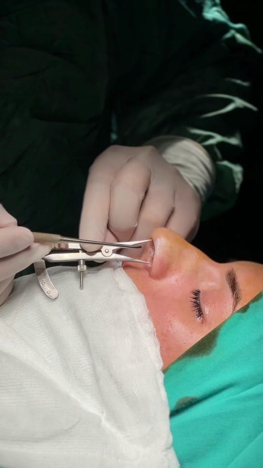 Post 3 by Op. Dr. Fatih Akgün on TikTok (video)