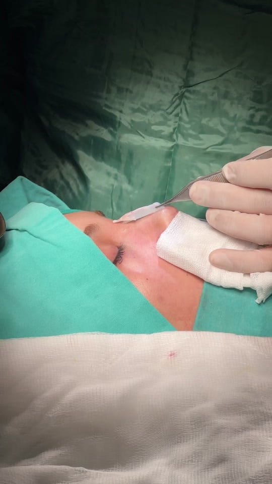 Post 2 by Op. Dr. Fatih Akgün on TikTok (video)