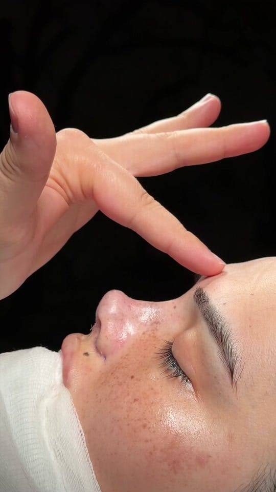 Post 5 by Op. Dr. Fatih Akgün on TikTok (video)