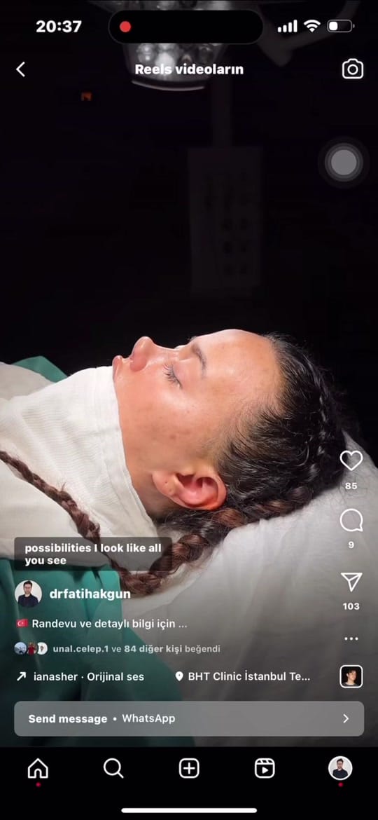 Post 1 by Op. Dr. Fatih Akgün on TikTok (video)