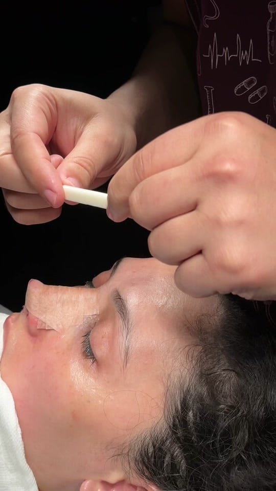 Post 8 by Op. Dr. Fatih Akgün on TikTok (video)