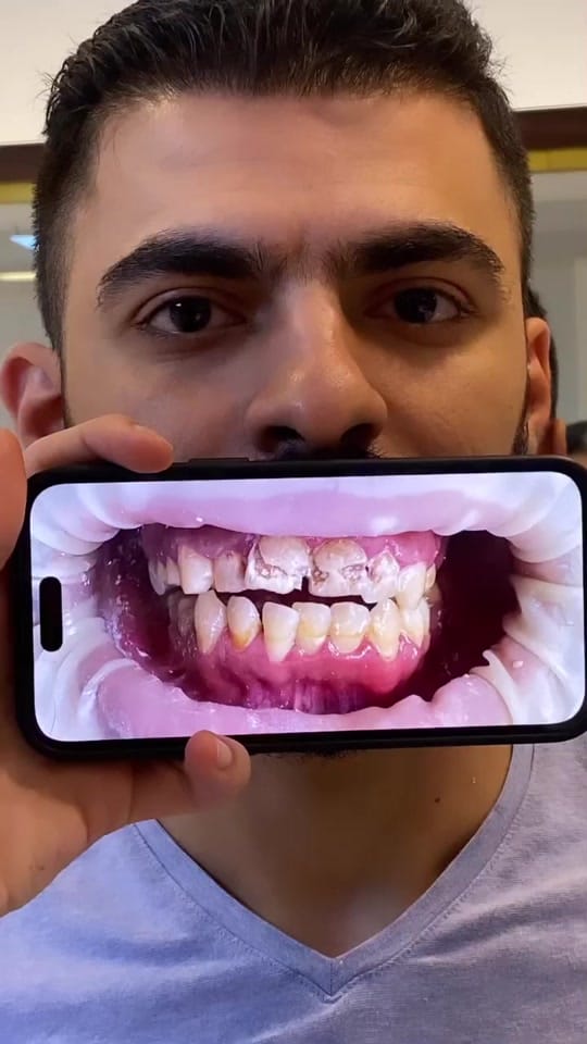 Post 6 by Health &  Beauty Turkey on TikTok (video)