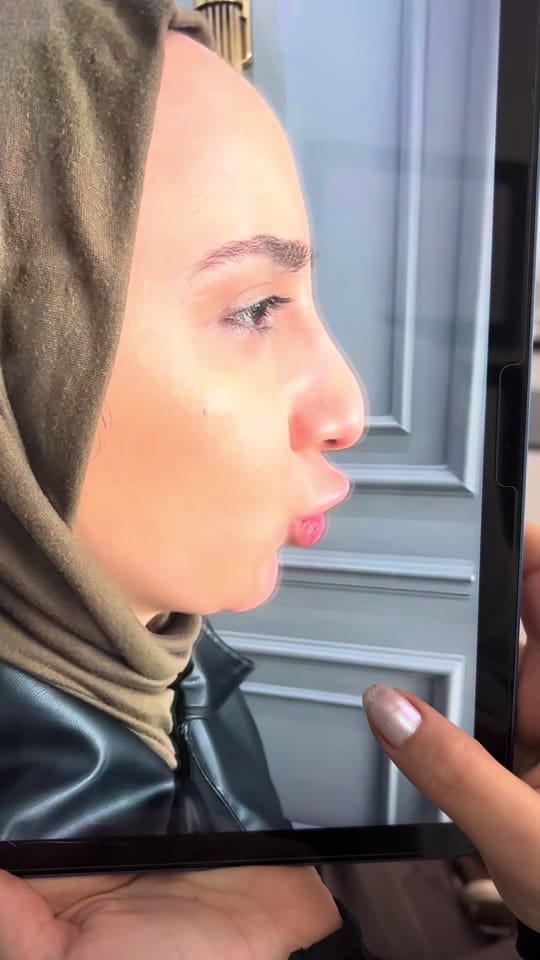 Post 8 by Dr.muhammed davud on TikTok (video)