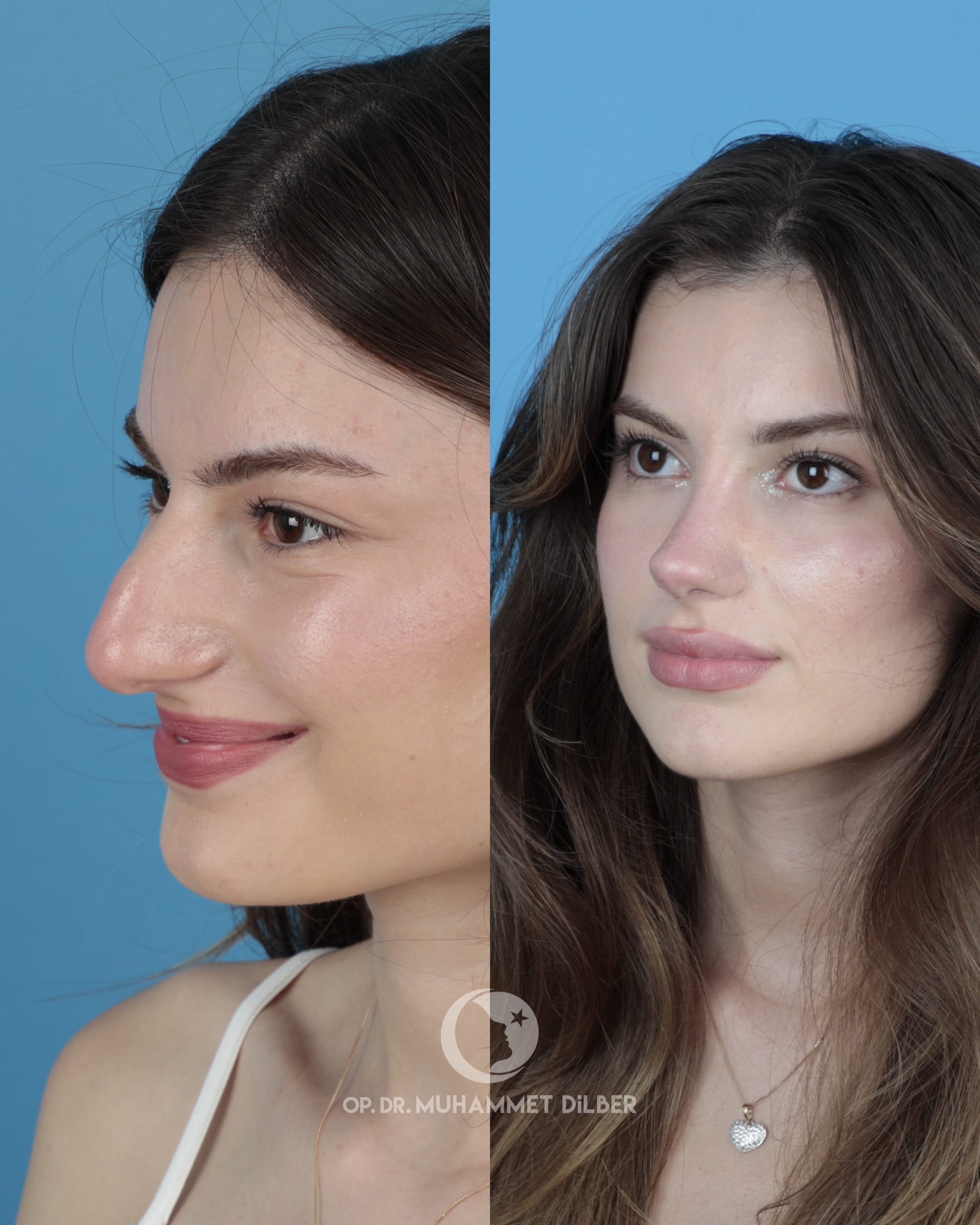 Post 9 by dr.muhammet.dilber on TikTok (video)